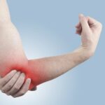 cách chữa bong gân cổ tay đứt dây chằng đau khớp háng bệnh án đau thần kinh tọa