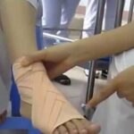 chữa bong gân cổ chân đứt dây chằng gối bệnh viêm khớp dạng thấp chữa đau thần kinh tọa