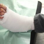 giãn dây chằng cổ chân đau dây chằng háng đau xương khớp bài thuốc trị bệnh thần kinh tọa